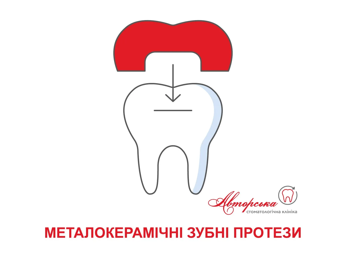 Схема: коронка над зубом, напис «Металокерамічні зубні протези»